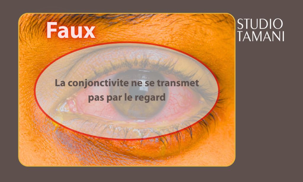 Non, la conjonctivite ne se transmet pas par le regard